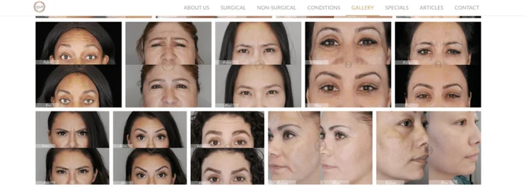 QaziClinic medspa treatment photos